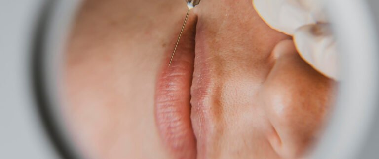 Dry Skin of the Hands is No Longer a Problem